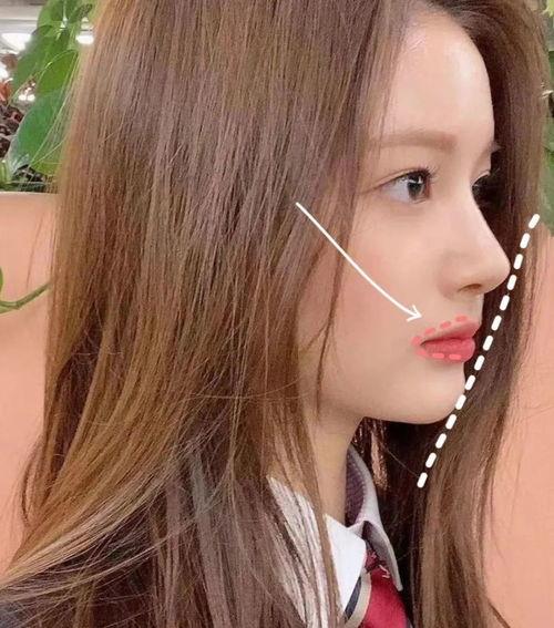 明星网红牙齿矫正对比,见证蜕变之美