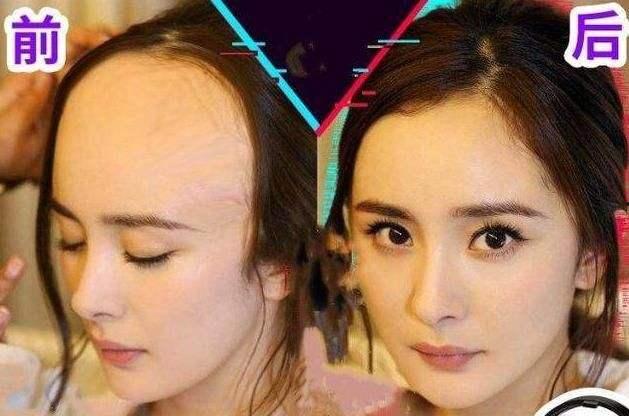 明星网红的发际线图片,时尚潮流下的发际线变迁