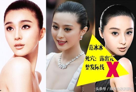明星网红的发际线图片,时尚潮流下的发际线变迁